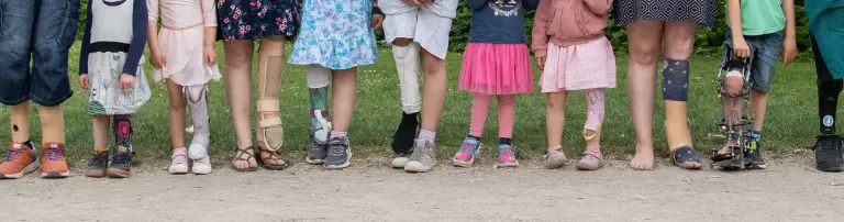 Bundesverband für PFFD, FFU, Fibula- und Tibiadefekte e.V. Header